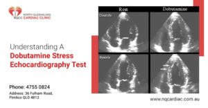 Understanding A Dobutamine Stress Echocardiography Test North