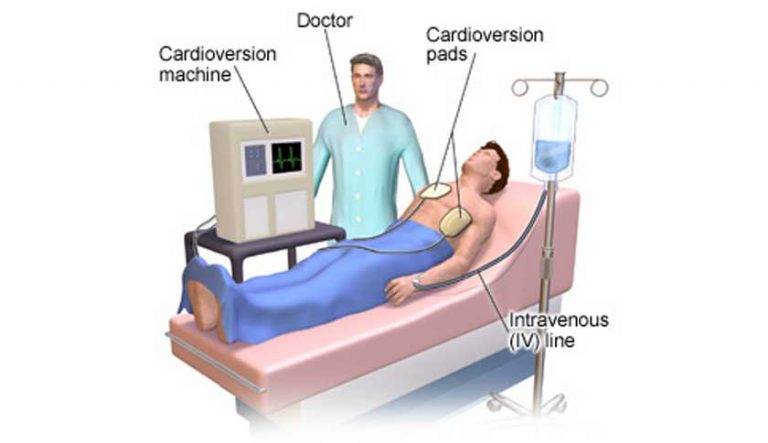 cardioversion-test-top-cardioversion-test-clinic-pimlico